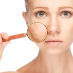 Home remedies for uneven skin tone
