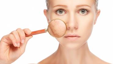Home remedies for uneven skin tone