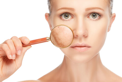 home remedies for uneven skin tone