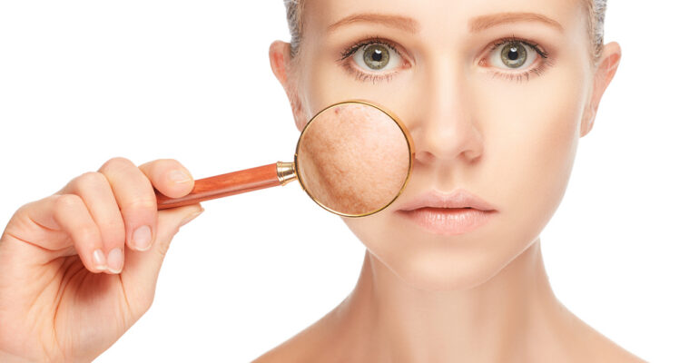 home remedies for uneven skin tone