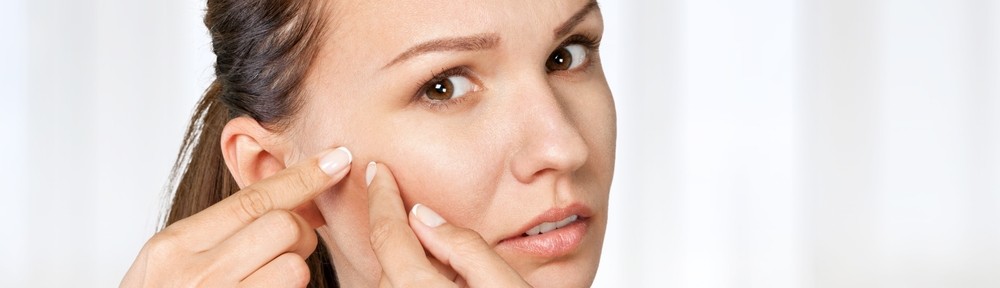 food that prevents acne