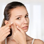 Foods That Prevent Acne