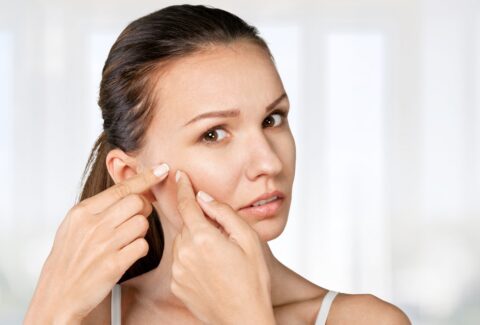 food that prevents acne