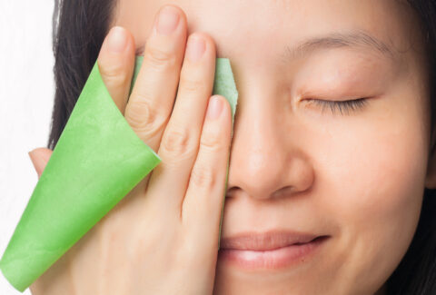 Acne and oily skin