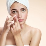 7 Acne Scar Home Remedies