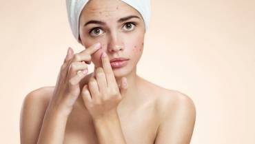 7 Acne Scar Home Remedies