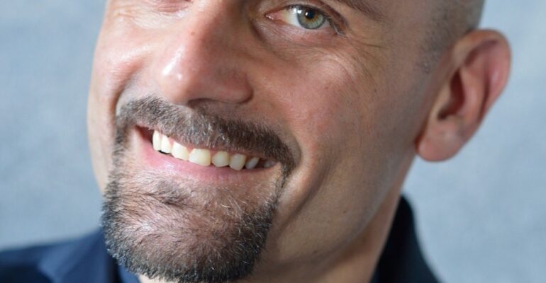 Different ways to cure Baldness