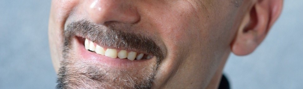 Different ways to cure Baldness