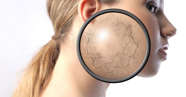 Healthy Diet for dry skin prevention