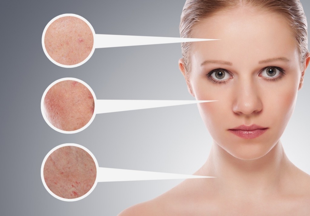 Home remedies for pigmentation