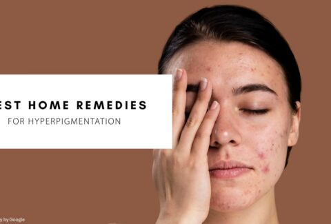 get rid of hyperpigmentation