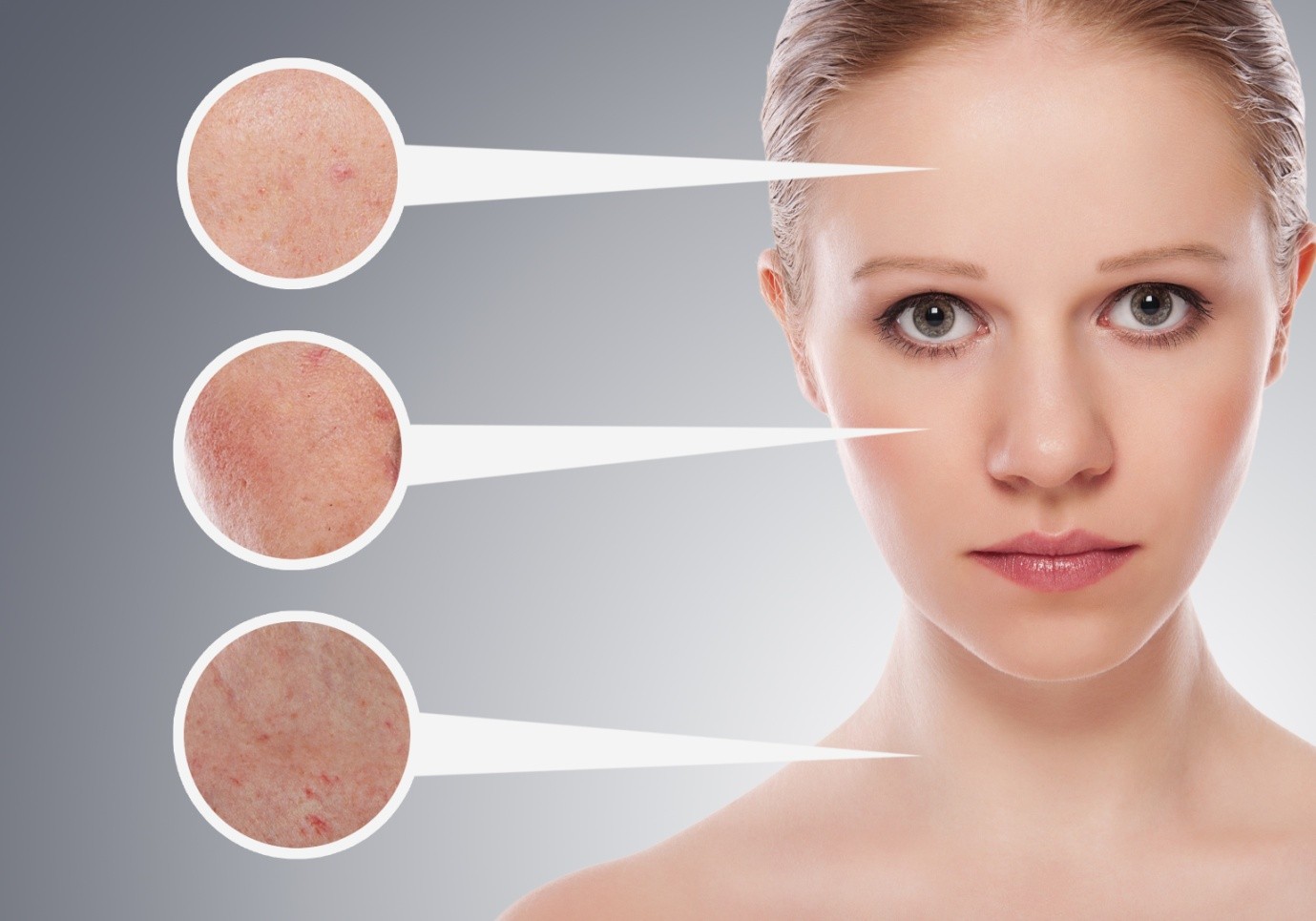 Home remedies for pigmentation | AllDayChemist Online 