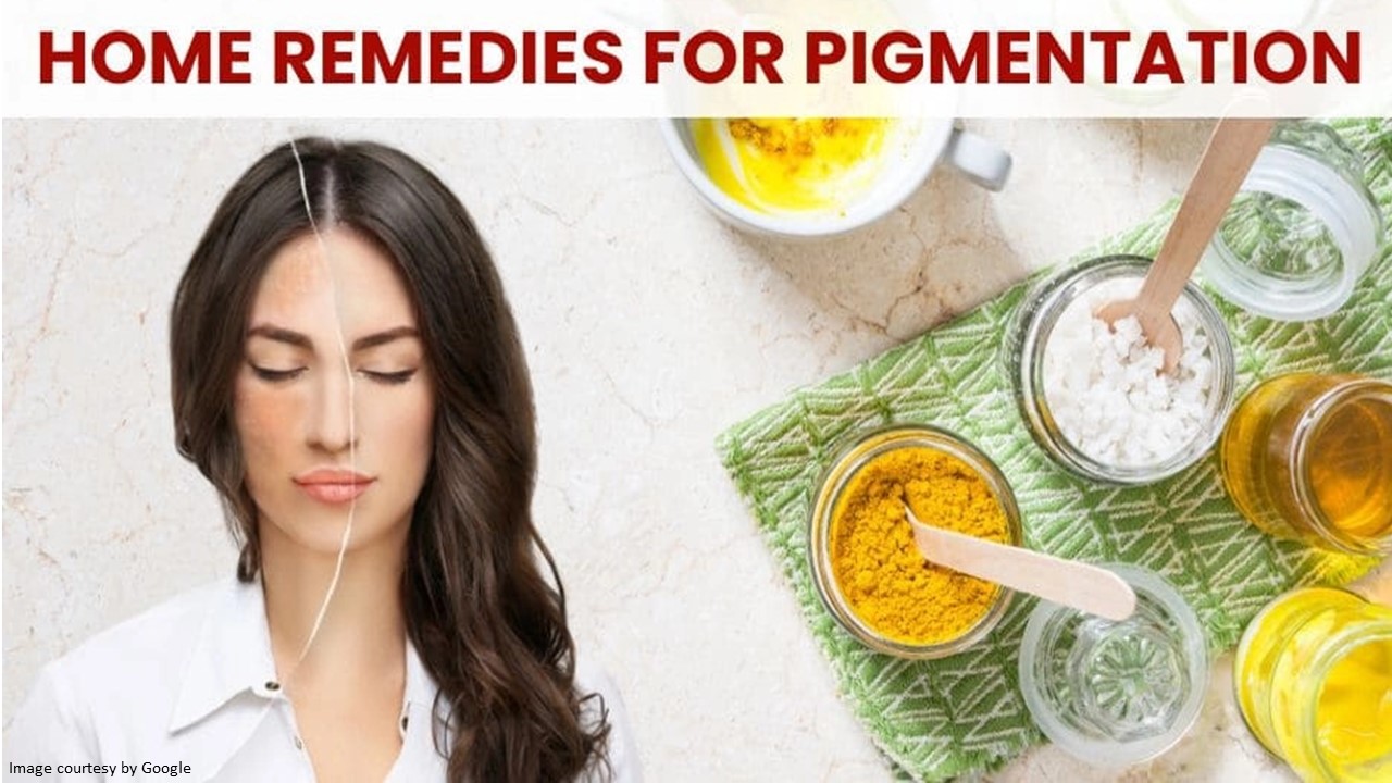 Say Goodbye to Pigmentation with Natural Home Remedies AllDayChemist