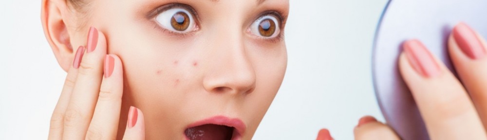 acne
