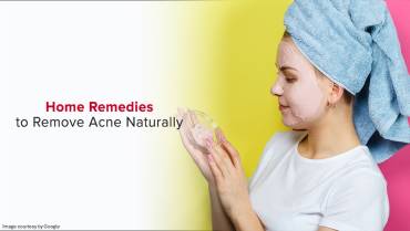 Home remedies for acne