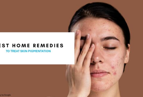 best treatment for hyperpigmentation