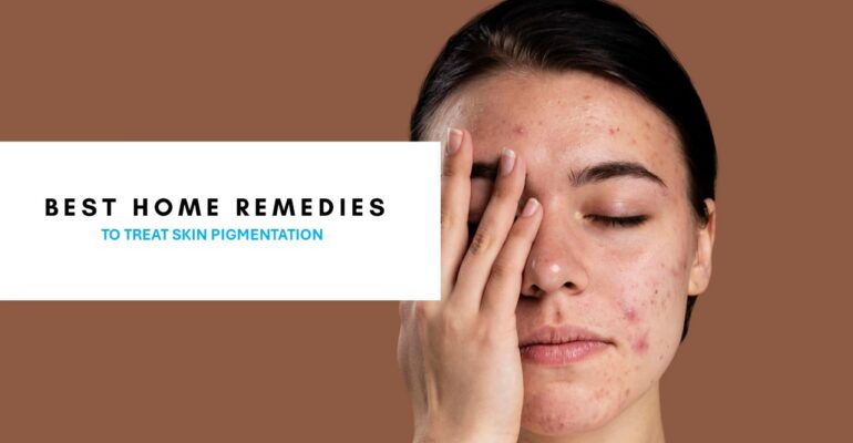 best treatment for hyperpigmentation