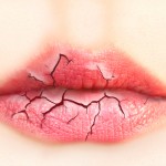 Home remedies for chapped lips