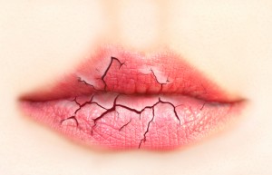 Home remedies for chapped lips