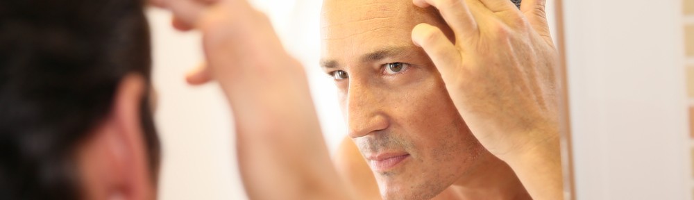 Home remedies for male pattern baldness