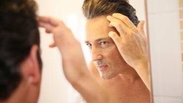 Home remedies for male pattern baldness