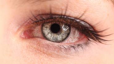 Understand effectiveness of home remedies for pink eye