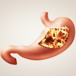 GAS AND BLOATING RELIEF