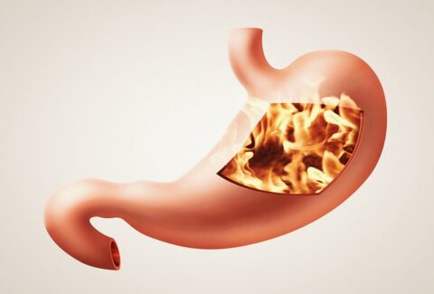 GAS AND BLOATING RELIEF