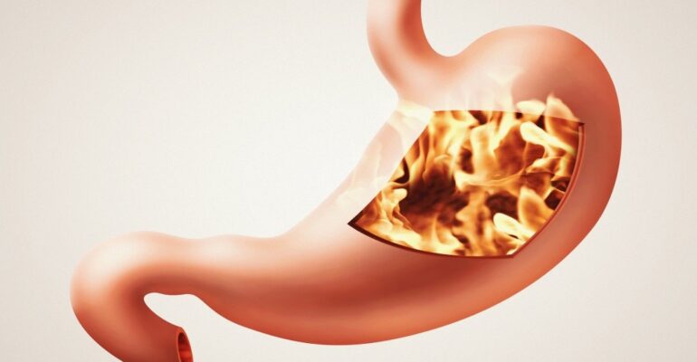 GAS AND BLOATING RELIEF