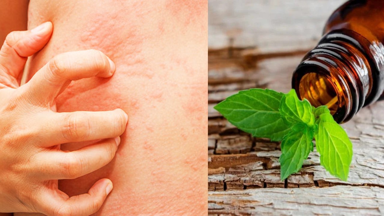 Home remedies to soothe itchy skin rashes: Aloe vera, oatmeal baths, cold compresses, tea tree oil, and chamomile tea.