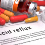 ACID REFLUX REMEDIES