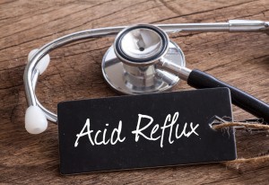 ACID REFLUX REMEDIES