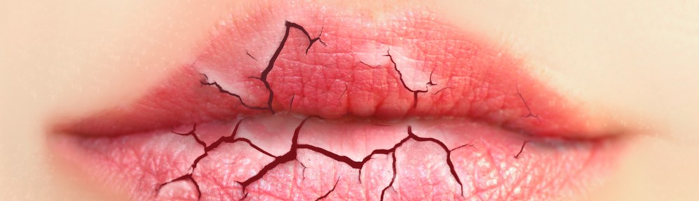 Remedies for Dry Lips
