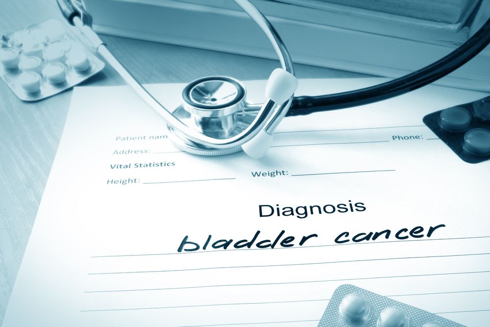 Bladder cancer causes, symptoms and treatment