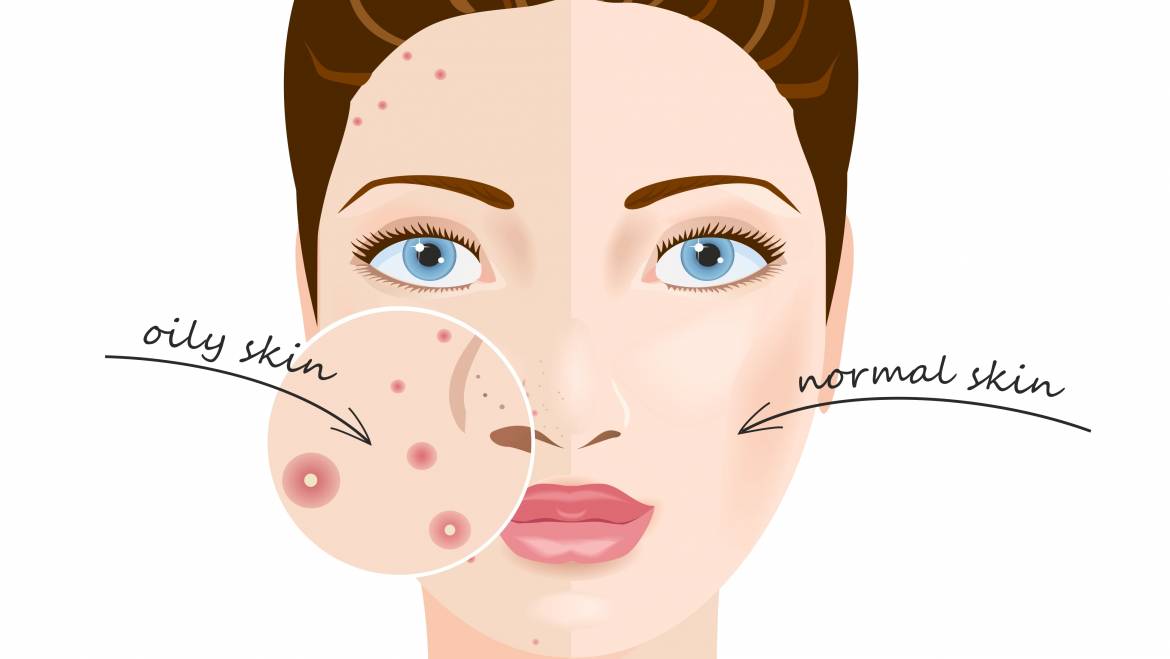 Oily Skin Care Essentials