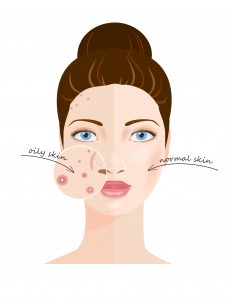 Oily Skin Care Essentials