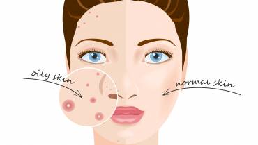 Oily Skin Care Essentials