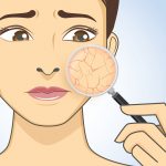 Tender Love and Care for Dry Skin