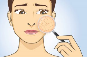 love and care for dry skin