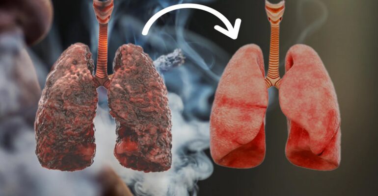 lung detox for smokers​ - All Day Chemist