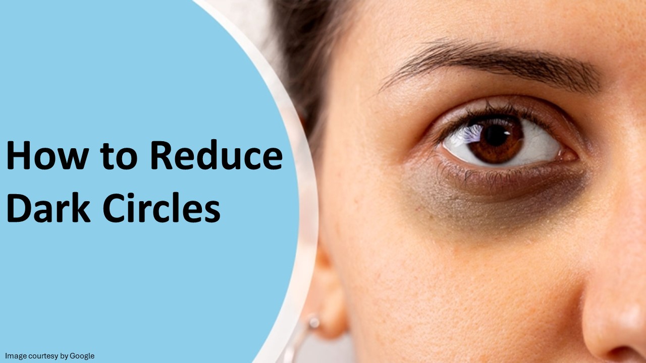 what causes dark circles under eyes