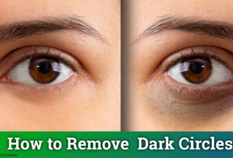 how to remove dark circles under eyes