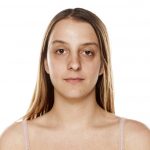 How to reduce dark circles?