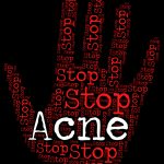 Natural and effective ways to treat acne