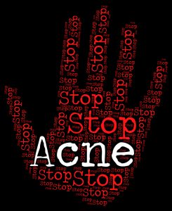 Natural and effective ways to treat acne
