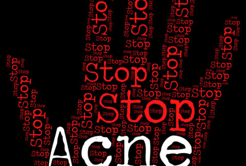Natural and effective ways to treat acne