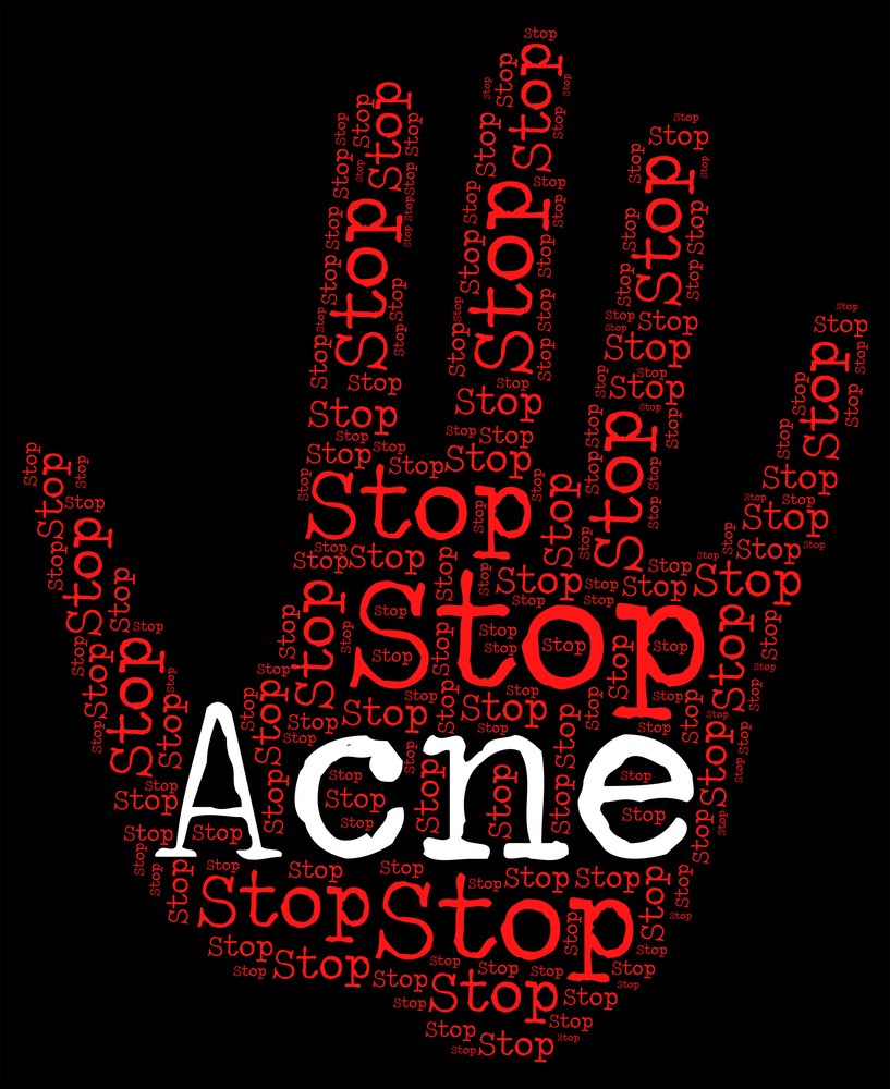 Natural and effective ways to treat acne