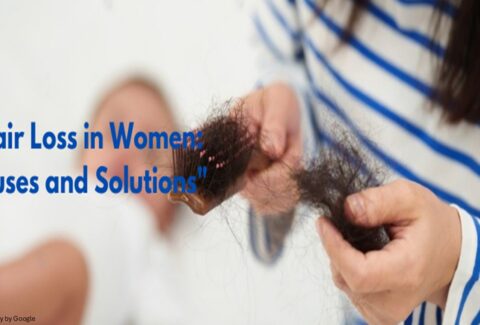 what causes female hair loss - ADC