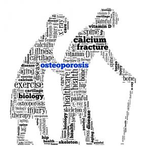 How to Prevent Osteoporosis and Osteoporosis Causes