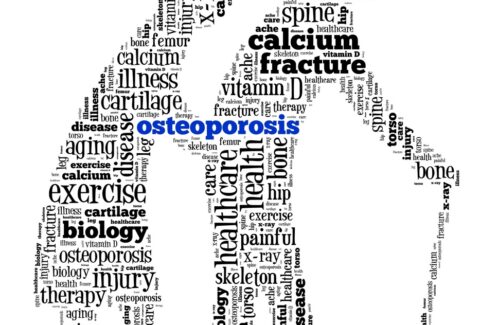 How to Prevent Osteoporosis and Osteoporosis Causes